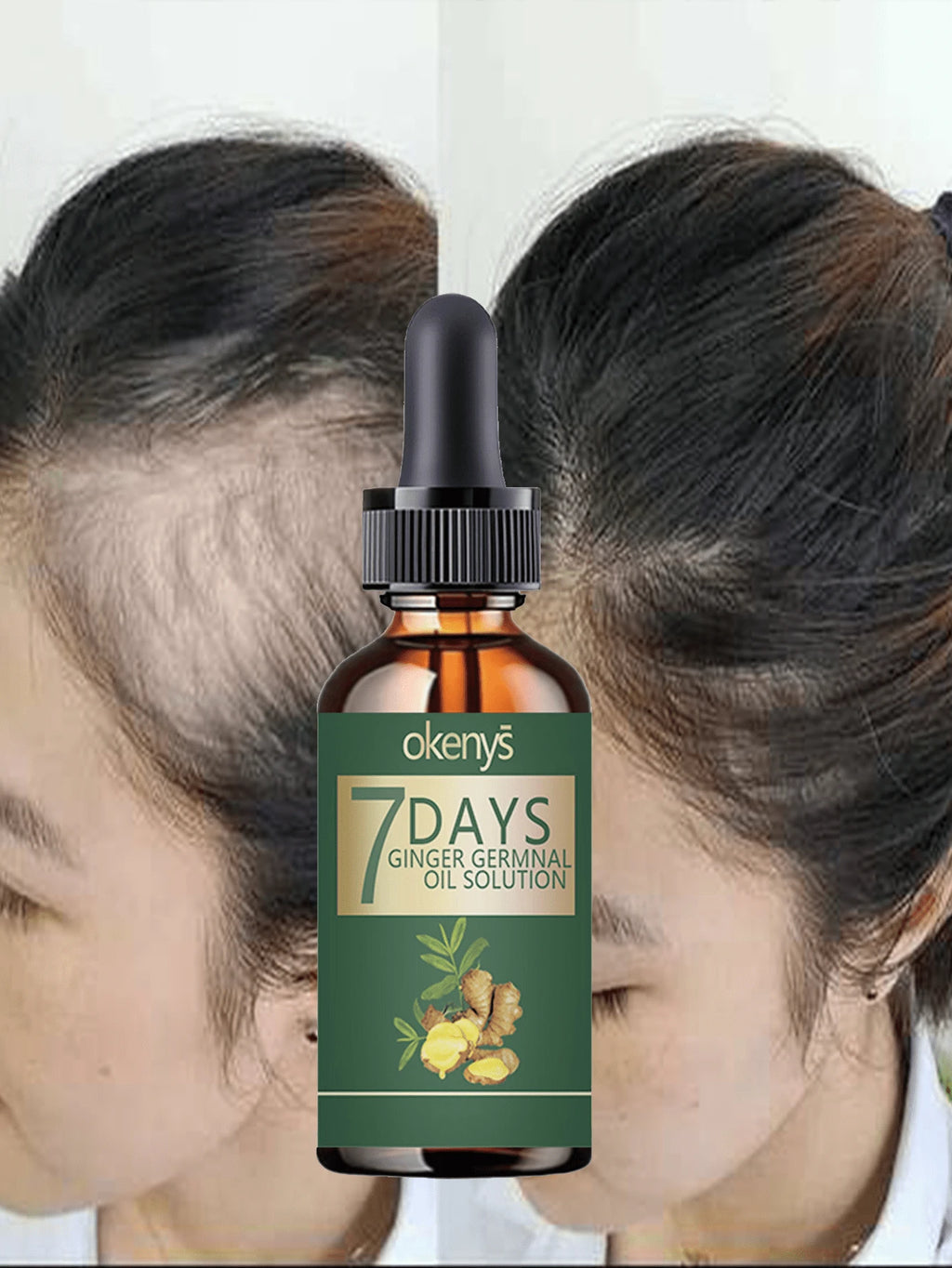 Say Goodbye To Baldness With Our Nourishing Hair Treatment For Thick Smooth And Voluminous Hair That Stays Flexible And Never Rough
