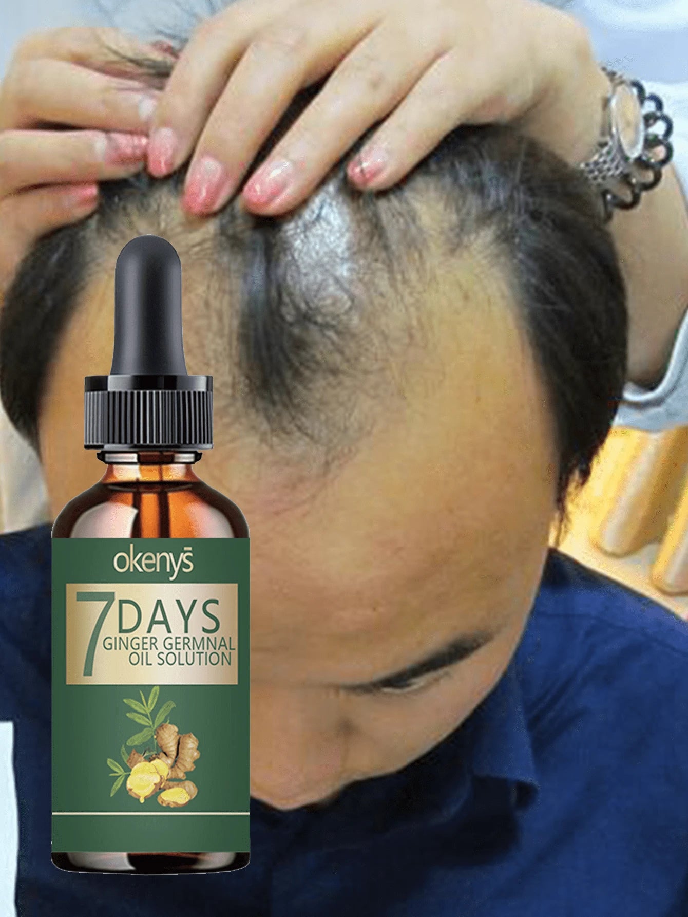 Say Goodbye To Baldness With Our Nourishing Hair Treatment For Thick Smooth And Voluminous Hair That Stays Flexible And Never Rough