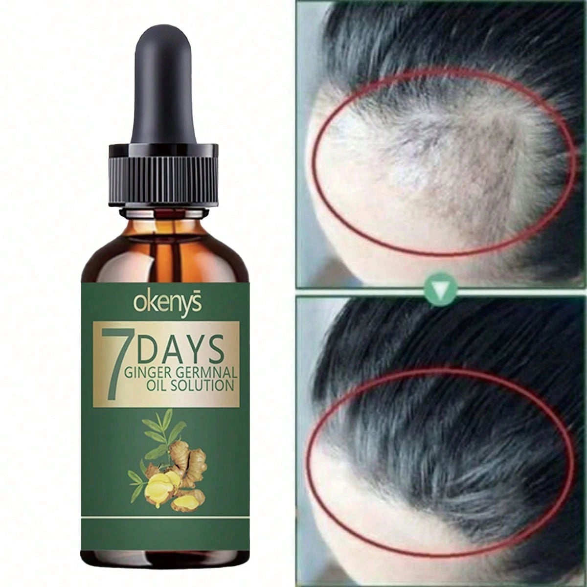 Say Goodbye To Baldness With Our Nourishing Hair Treatment For Thick Smooth And Voluminous Hair That Stays Flexible And Never Rough