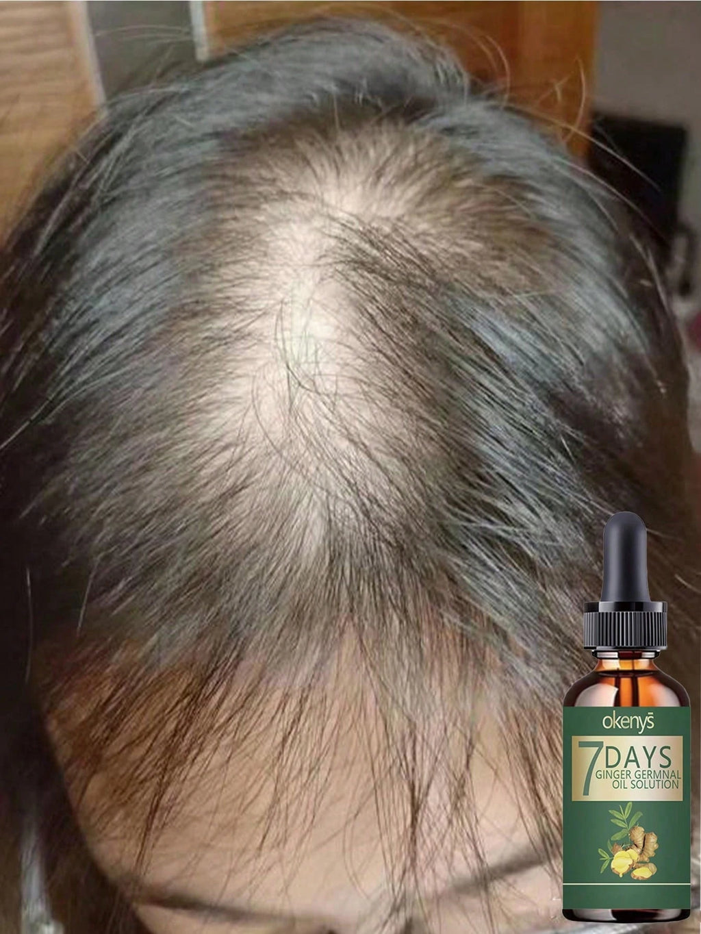 Say Goodbye To Baldness With Our Nourishing Hair Treatment For Thick Smooth And Voluminous Hair That Stays Flexible And Never Rough